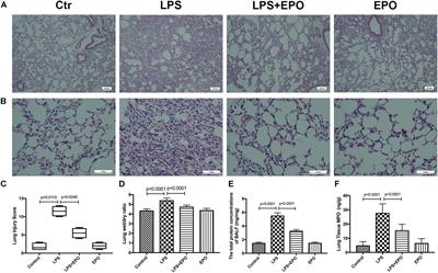 Suppression of NLRP3 Inflammasome by Erythropoietin via the EPOR/JAK2/STAT3 Pathway Contributes to Attenuation of Acute Lung Injury in Mice